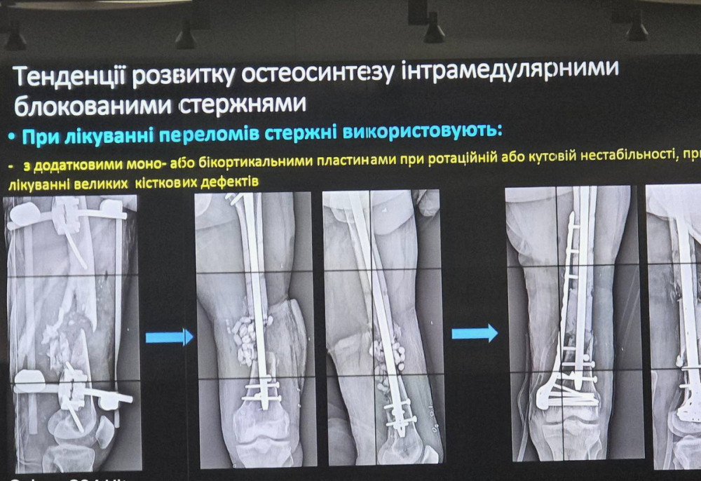 image for slide